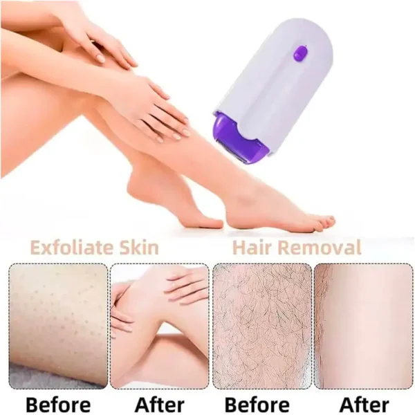 hair removal machine epilator